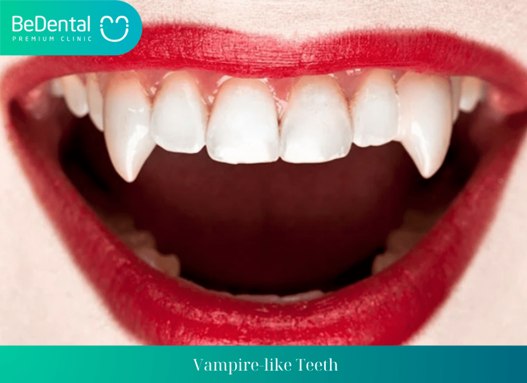 Vampire like Teeth