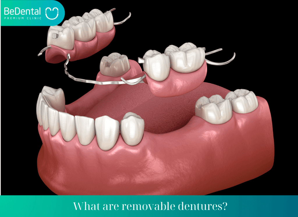 the process of making removable dentures