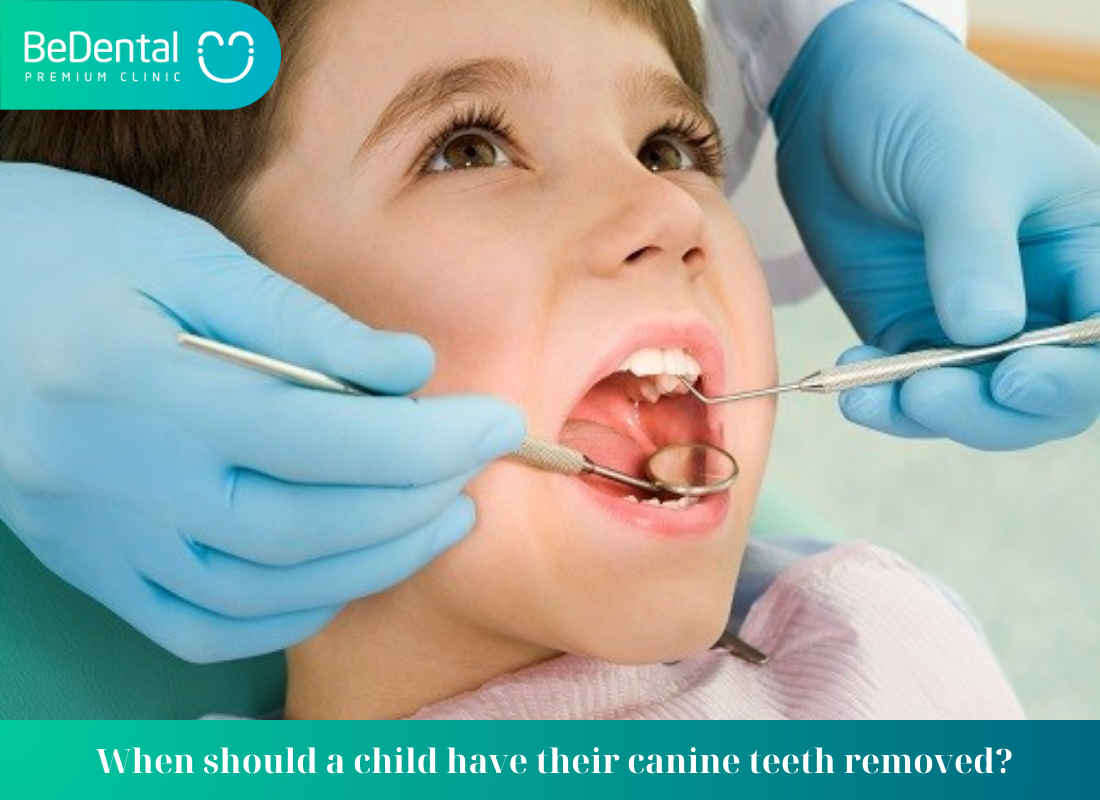 When should a child have their canine teeth removed