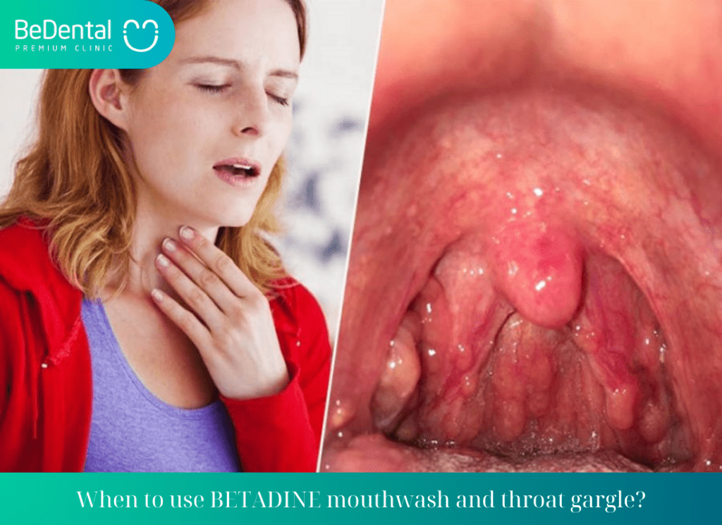 When to use BETADINE mouthwash and throat gargle