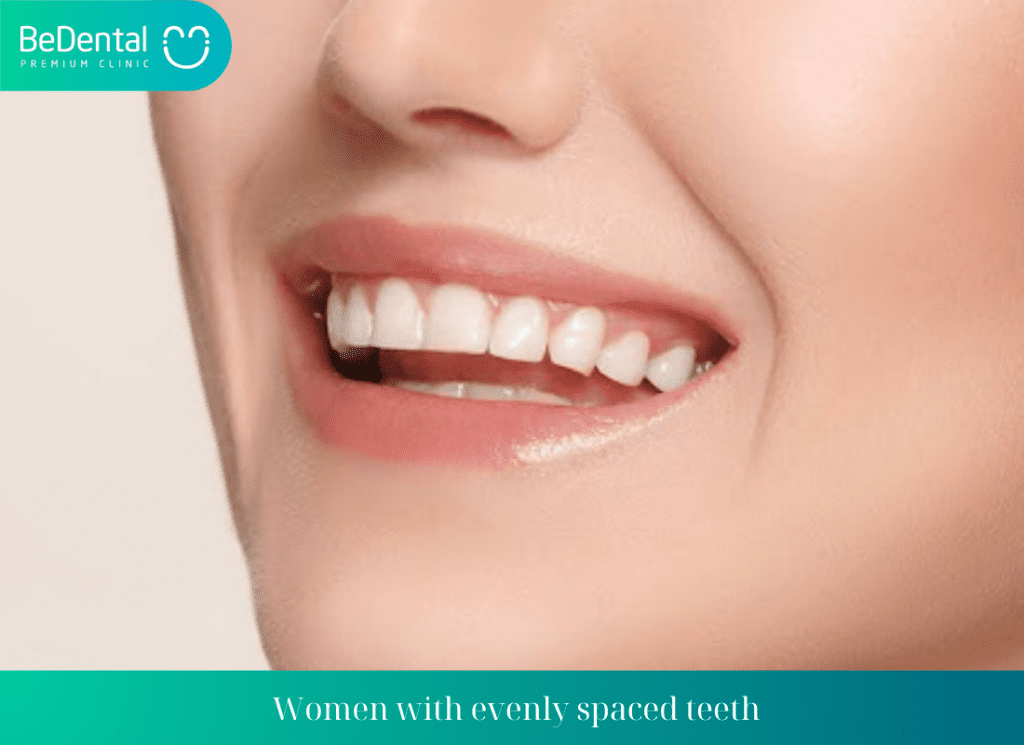 Women with evenly spaced teeth