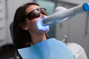 Chairside whitening costs approximately 3.000.000 VND each visit (on average) across the country.