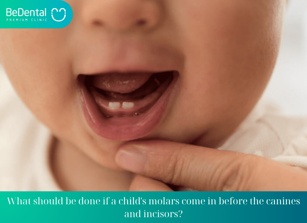 What should be done if a childs molars come in before the canines and incisors