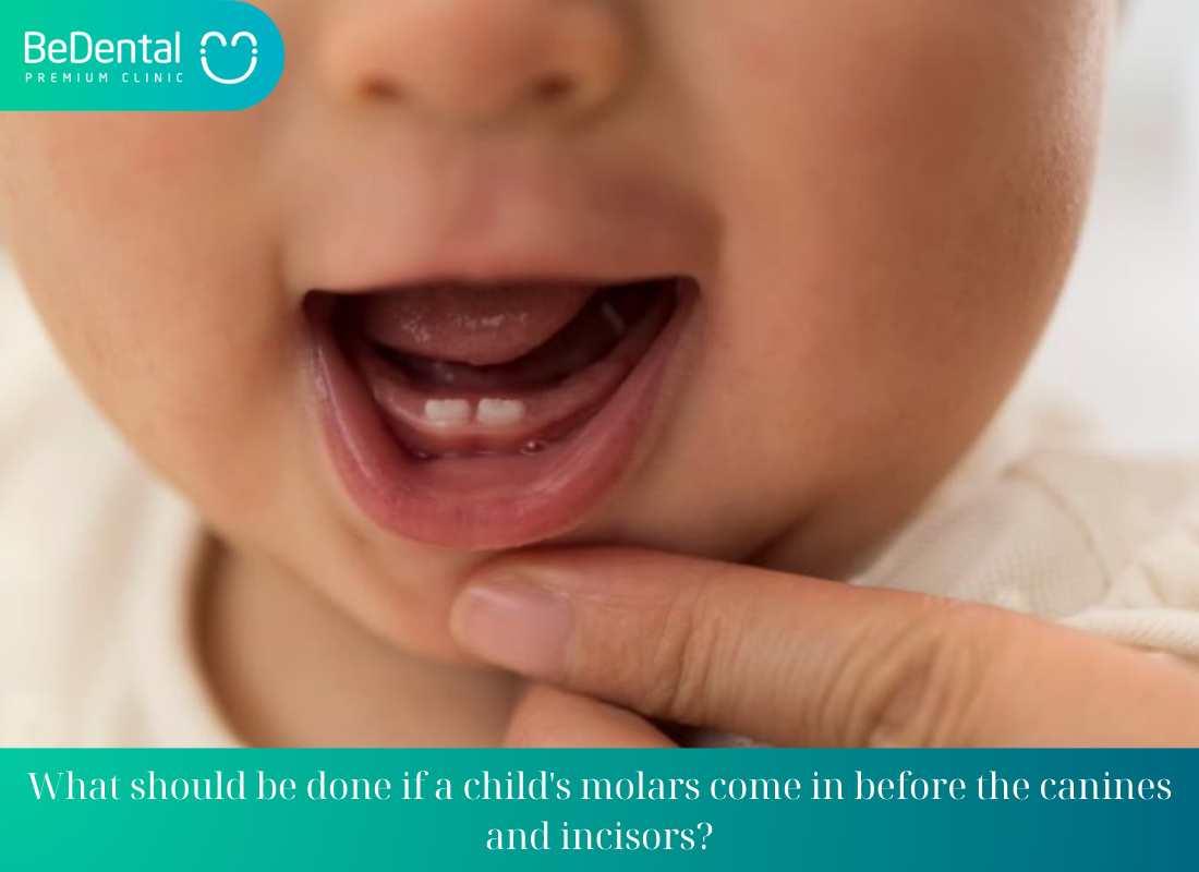 What should be done if a childs molars come in before the canines and incisors