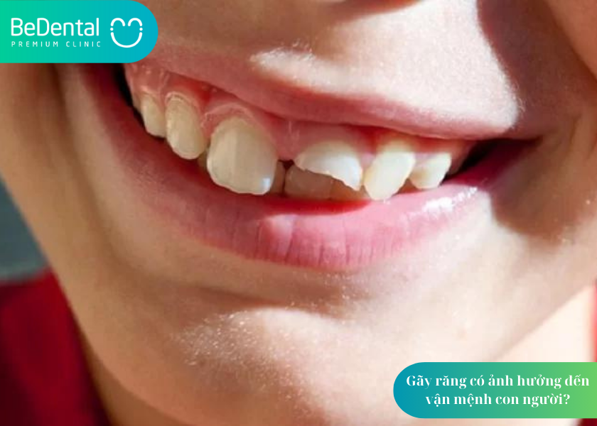 Răng có ảnh hưởng đến vận mệnh con người ?