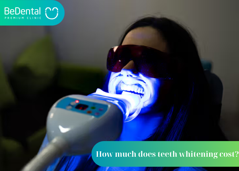 How much does teeth whitening cost? Does teeth whitening affect oral health? Causes of tooth discoloration
