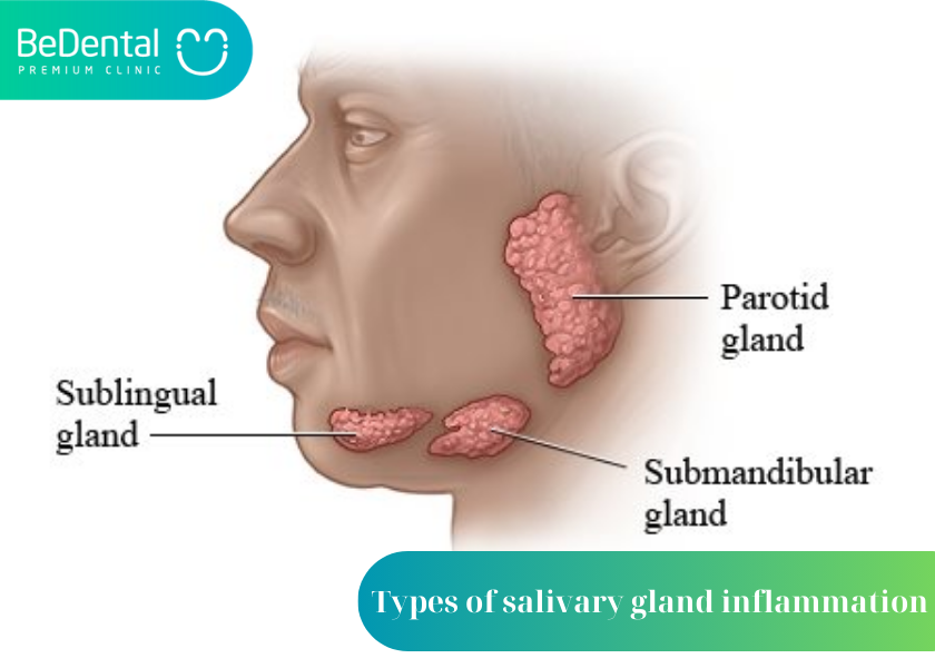 What are salivary glands?
