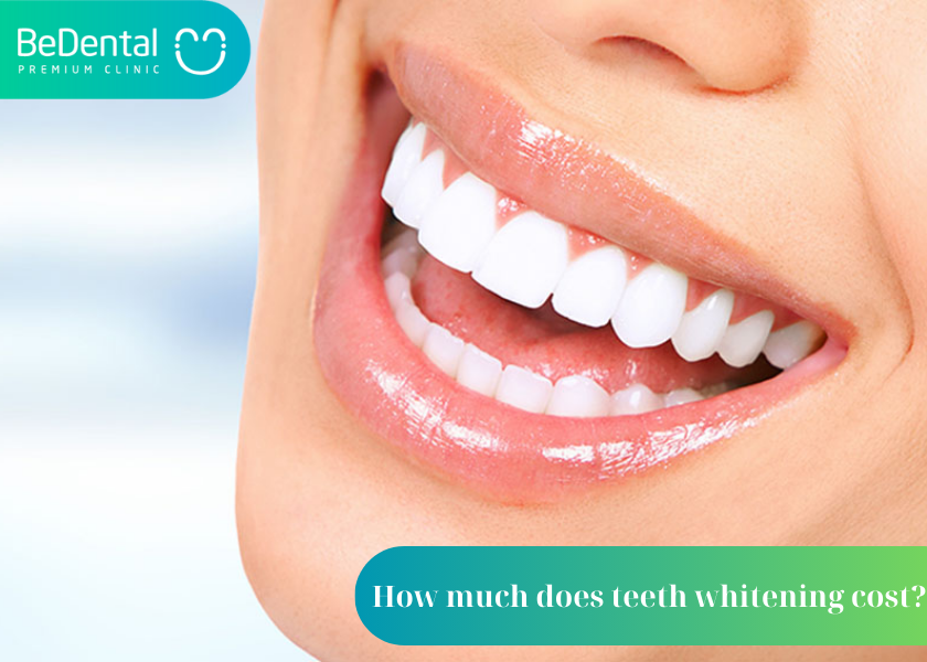 How much does teeth whitening cost
