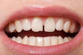 Răng có ảnh hưởng đến vận mệnh con người ?