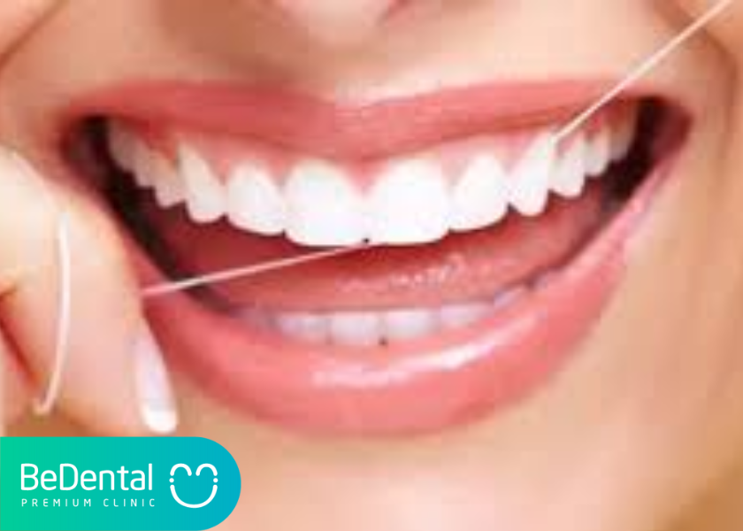Biện pháp ngăn chặn nguy cơ bị tụt lợi khi niềng răng