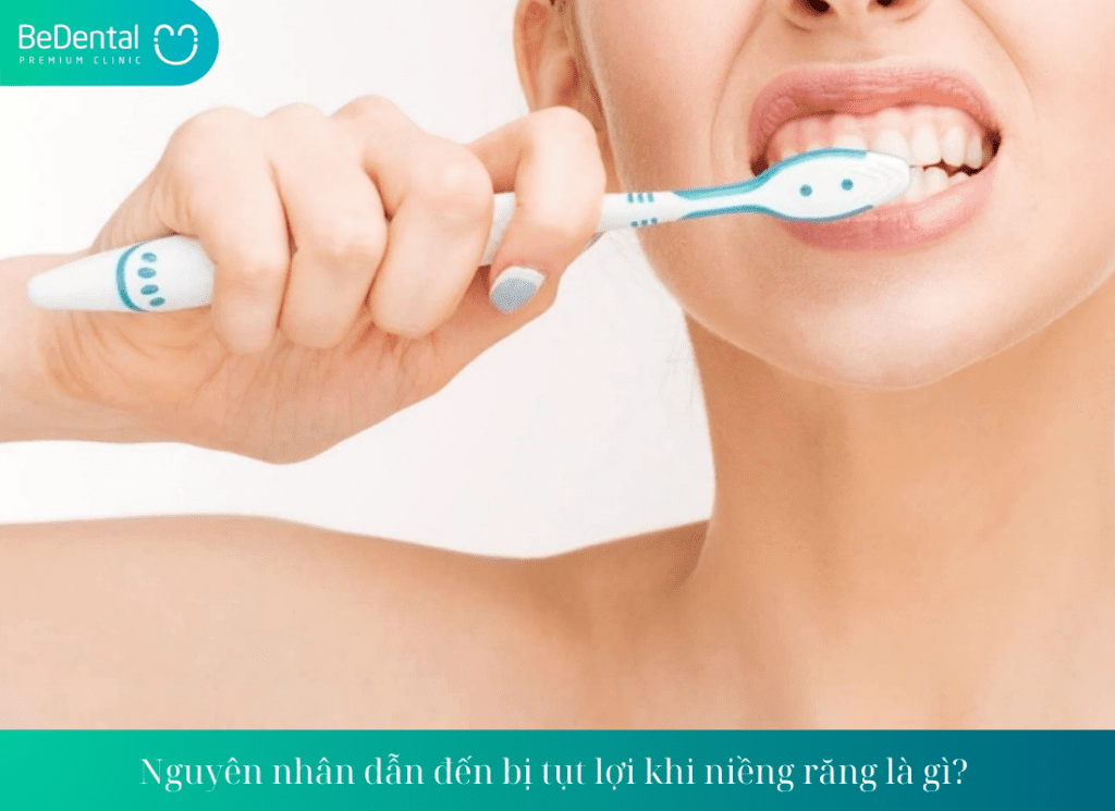 Nguyên nhân dẫn đến bị tụt lợi khi niềng răng là gì? 