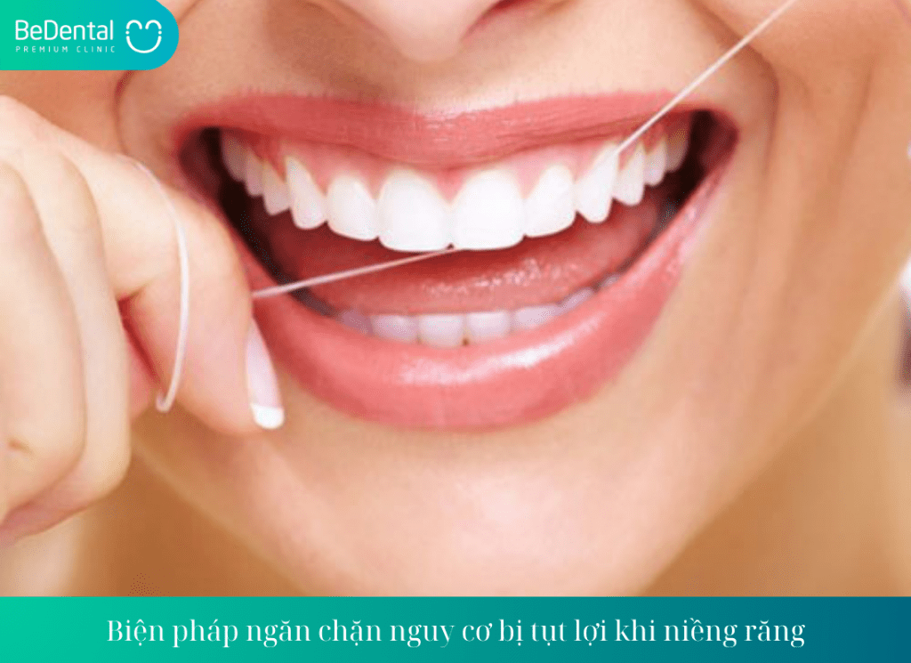 Biện pháp ngăn chặn nguy cơ bị tụt lợi khi niềng răng