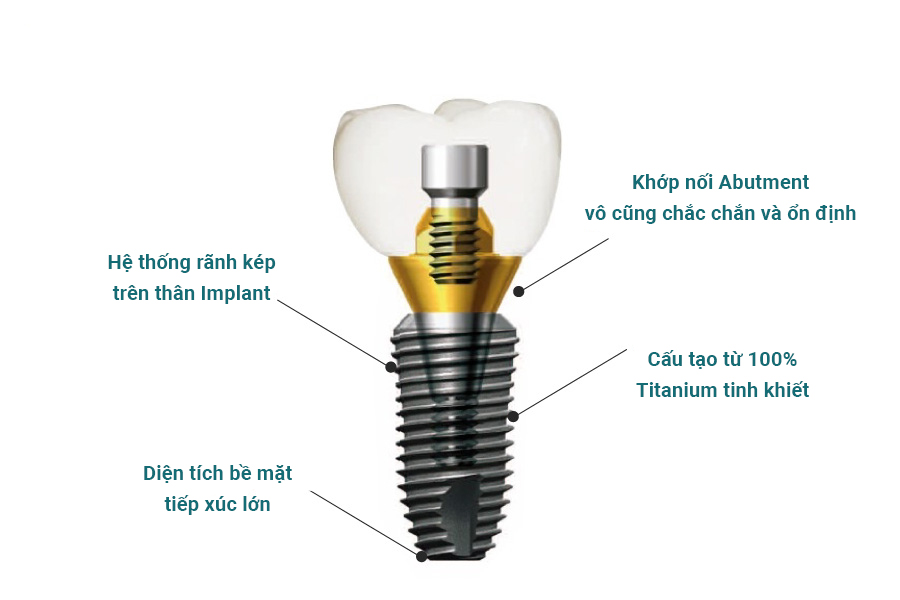 cau tao cua tru implant dentium superline my