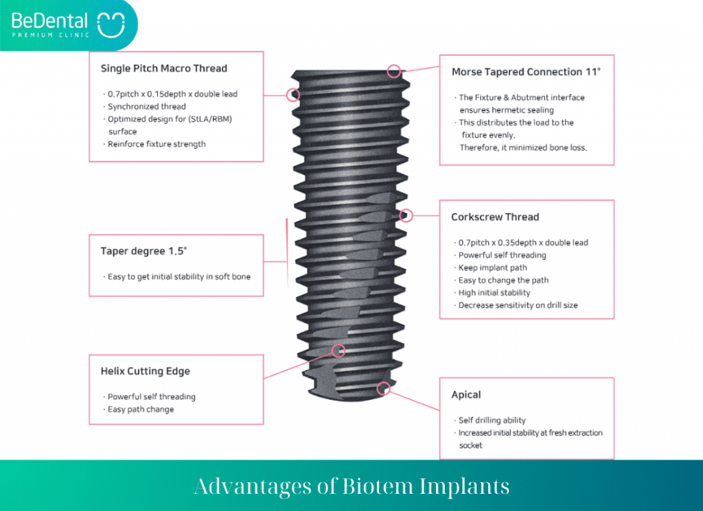 Advantages of Biotem Implants