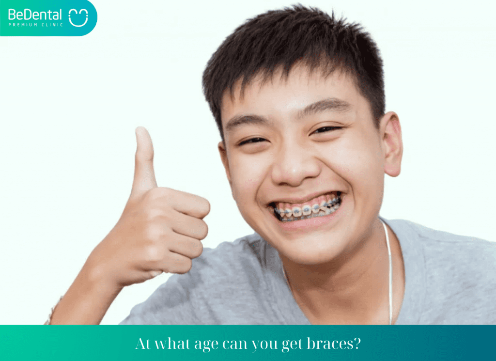 What Is the Appropriate Age for Braces