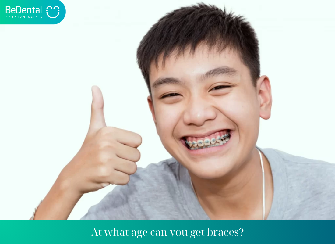 At what age can you get braces