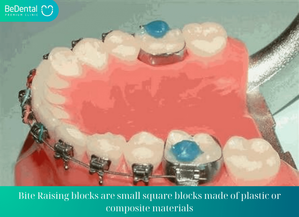 Bite Raising blocks are small square blocks made of plastic or composite materials