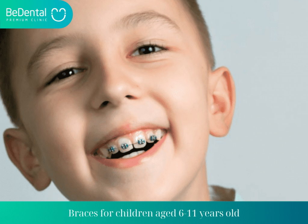 Braces for children aged 6 11 years old