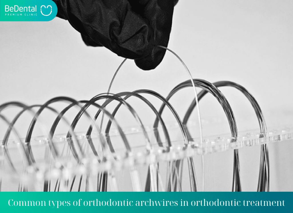 Common types of orthodontic archwires in orthodontic treatment