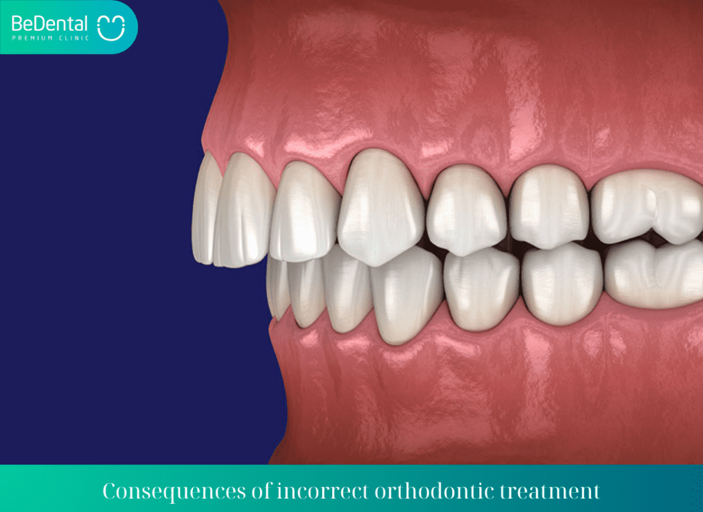 Consequences of incorrect orthodontic treatment