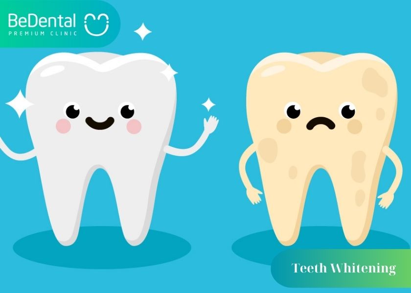 How much does affordable and reputable teeth whitening cost?