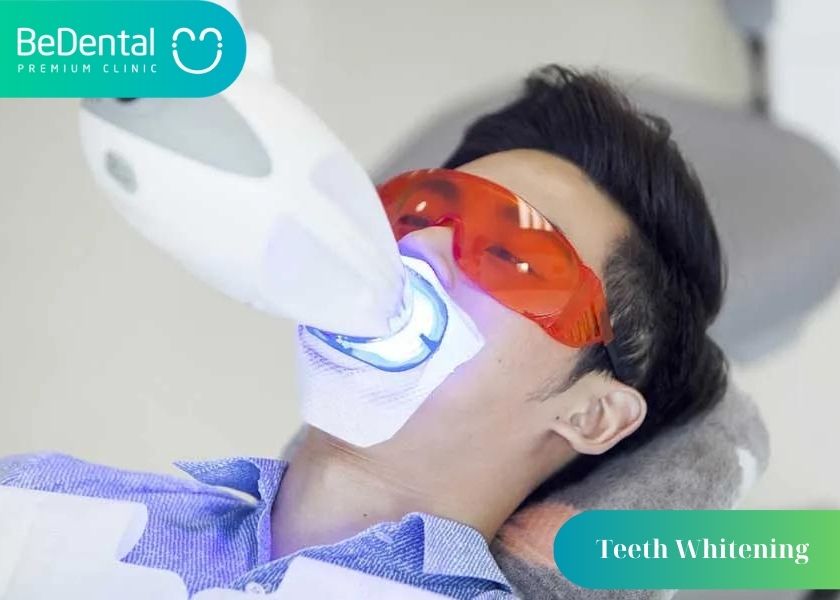 How much does affordable and reputable teeth whitening cost?