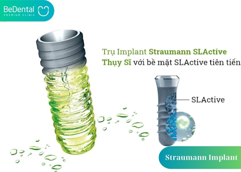 Advantages of the Straumann Swiss Implant