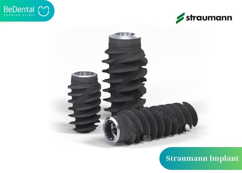 Advantages of the Straumann Swiss Implant