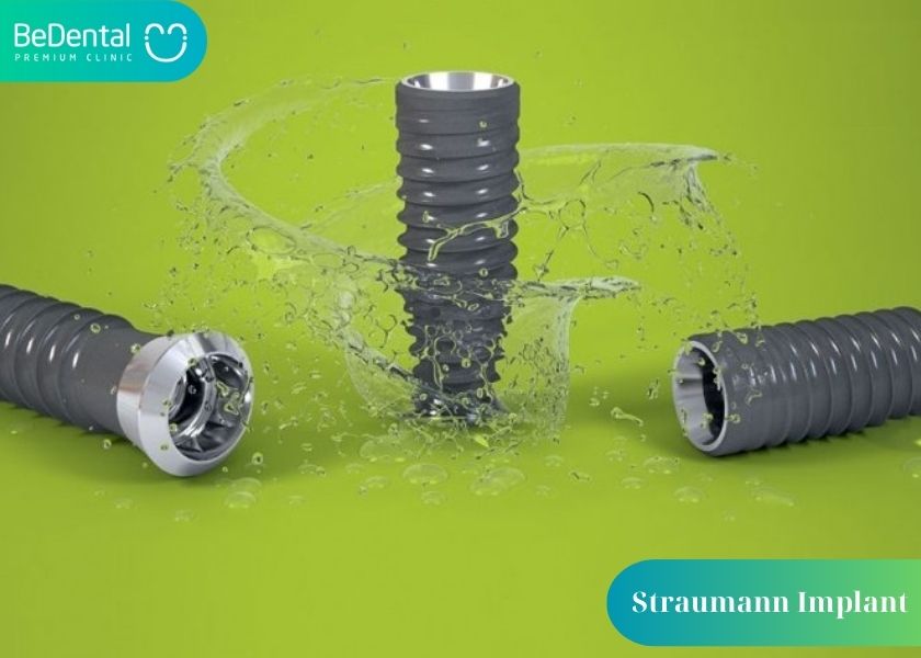 Advantages of the Straumann Swiss Implant