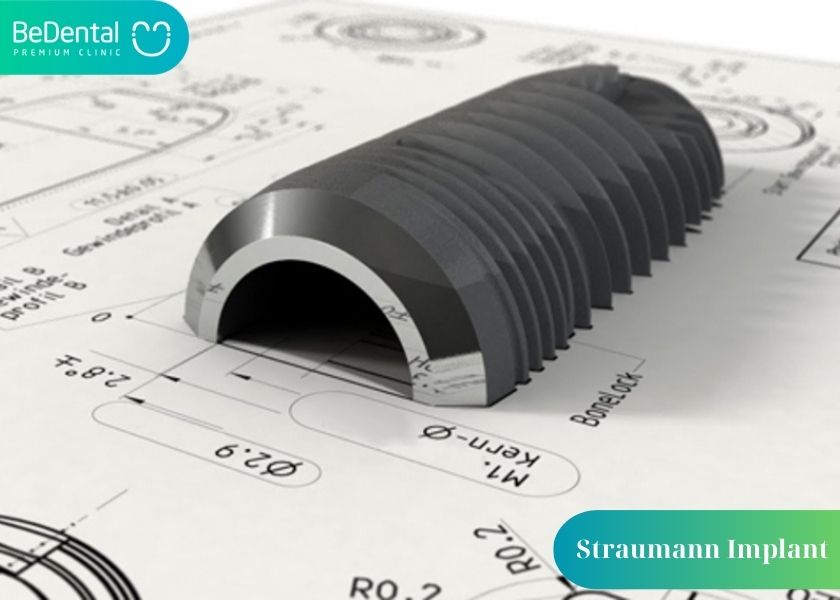 Advantages of the Straumann Swiss Implant