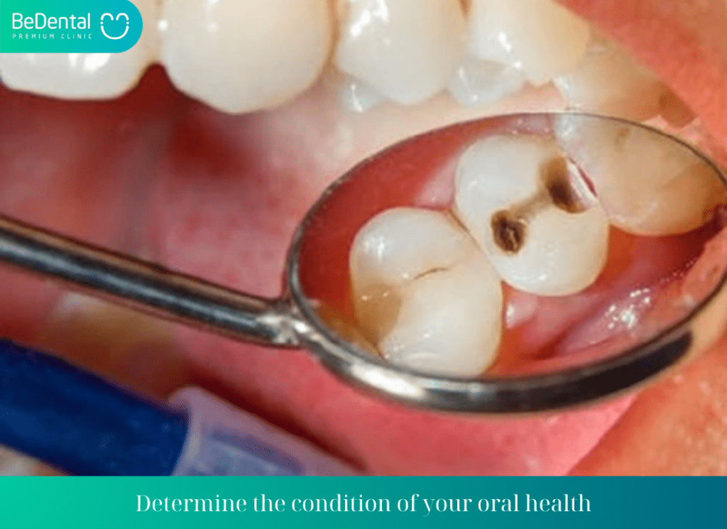 Determine the condition of your oral health