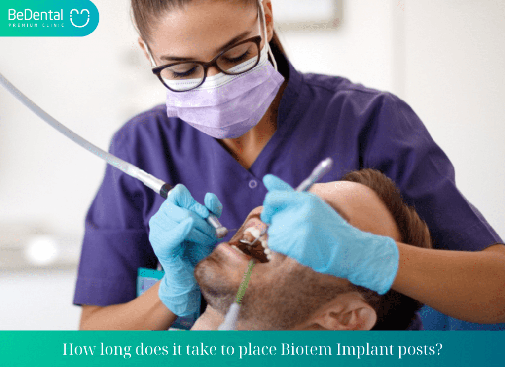 How long does it take to place Biotem Implant posts