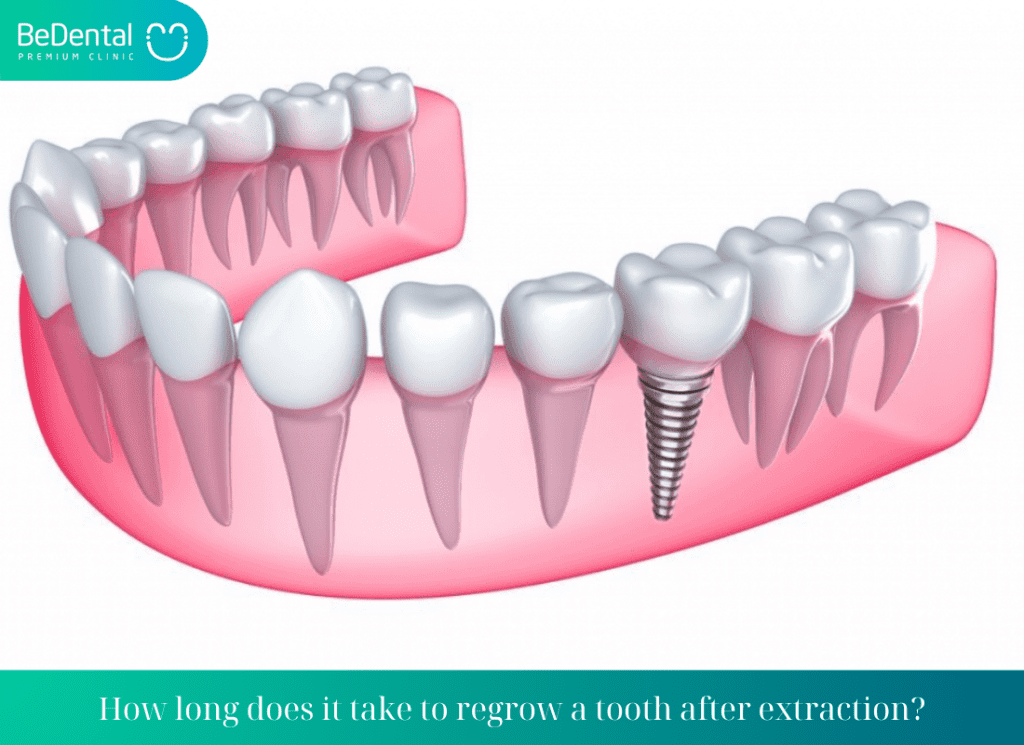 What is tooth Regrowth Time After Extraction