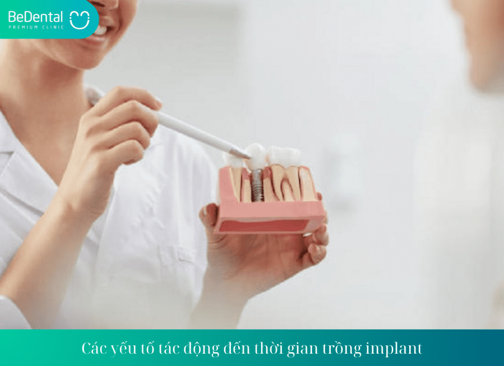 Các yếu tố tác động đến thời gian trồng implant