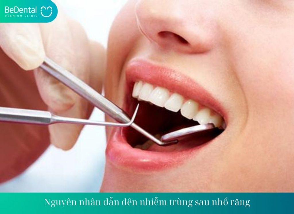 Nguyên nhân dẫn đến nhiễm trùng sau nhổ răng