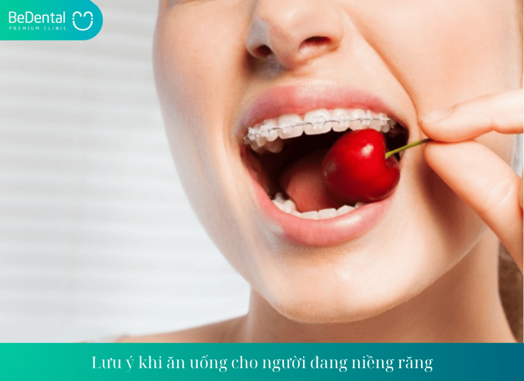 Lưu ý khi ăn uống cho người đang niềng răng