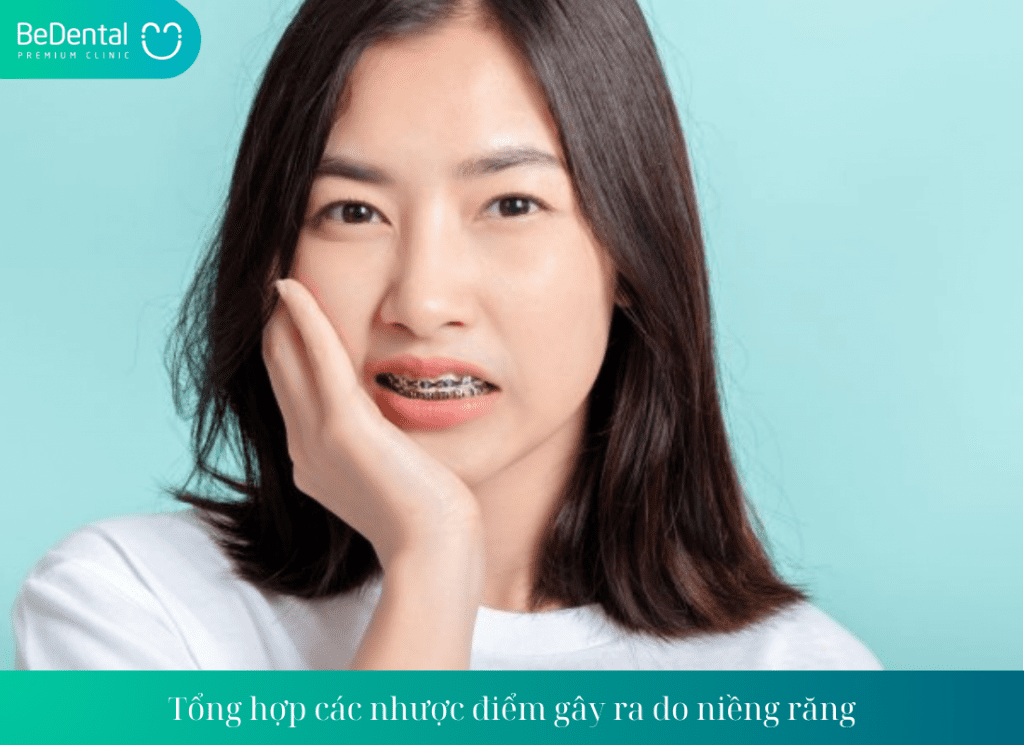 Tổng hợp các nhược điểm gây ra do niềng răng - Niềng răng có ảnh hưởng gì không?