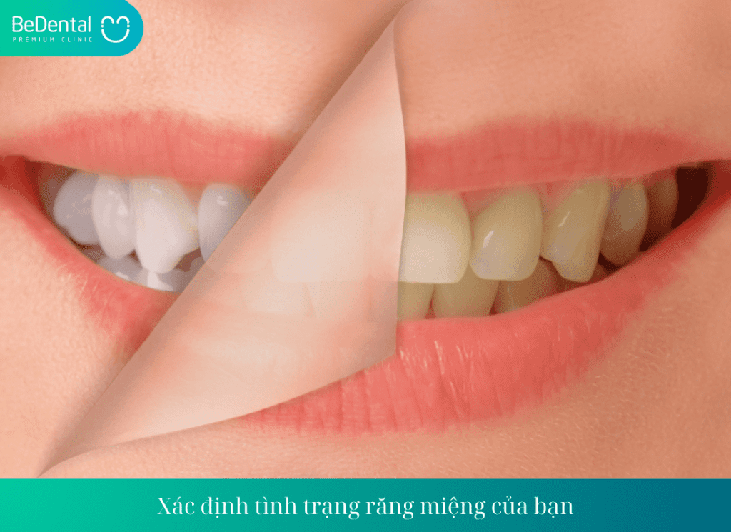 Xác định tình trạng răng miệng của bạn