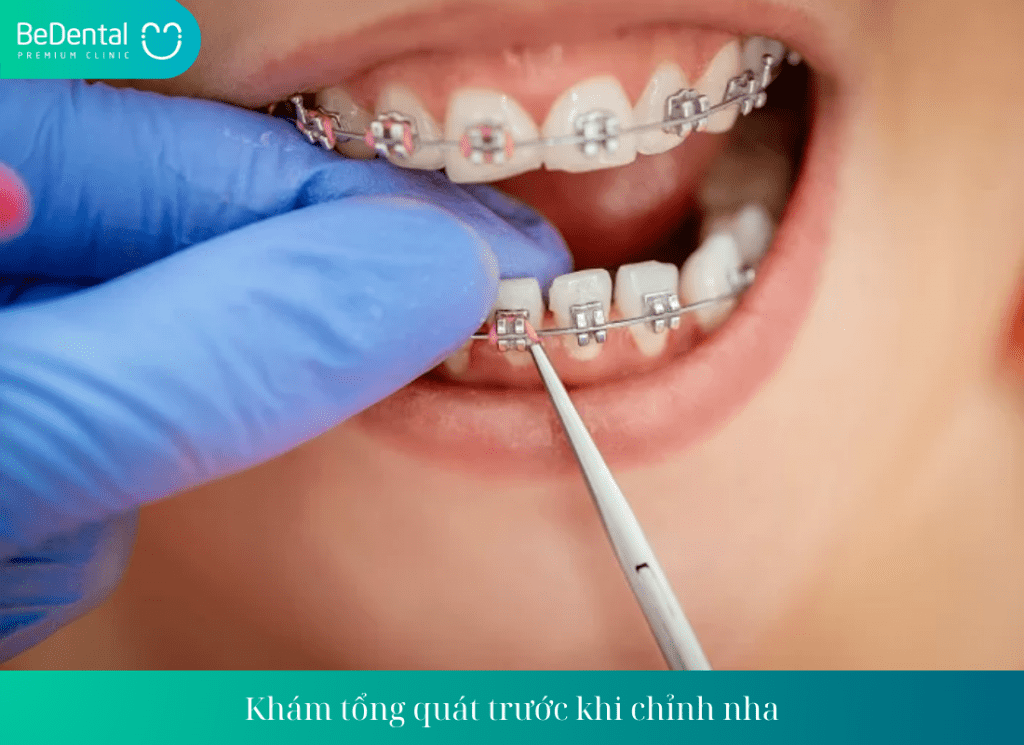 Khám tổng quát trước khi chỉnh nha