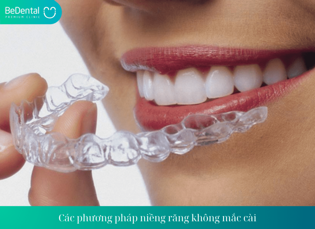 Các phương pháp niềng răng không mắc cài