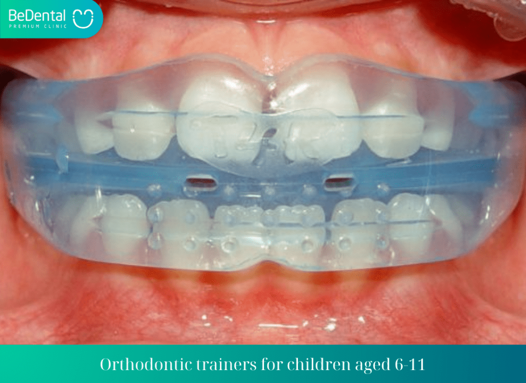 Orthodontic trainers for children aged 6 11