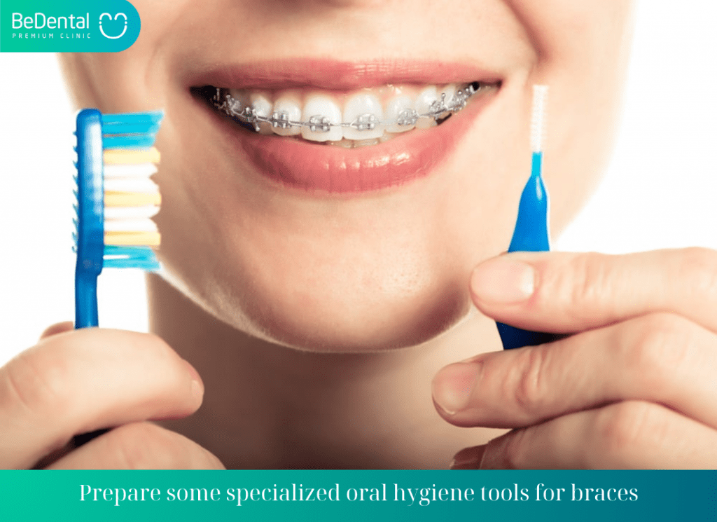 Prepare some specialized oral hygiene tools for braces