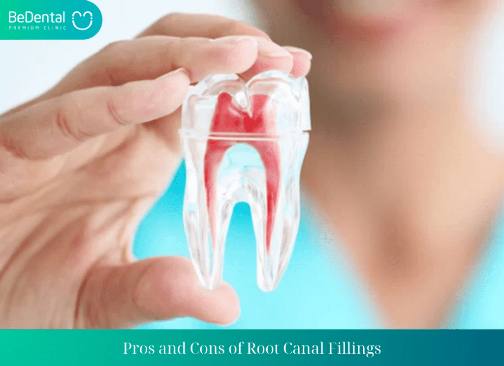 Pros and Cons of Root Canal Fillings