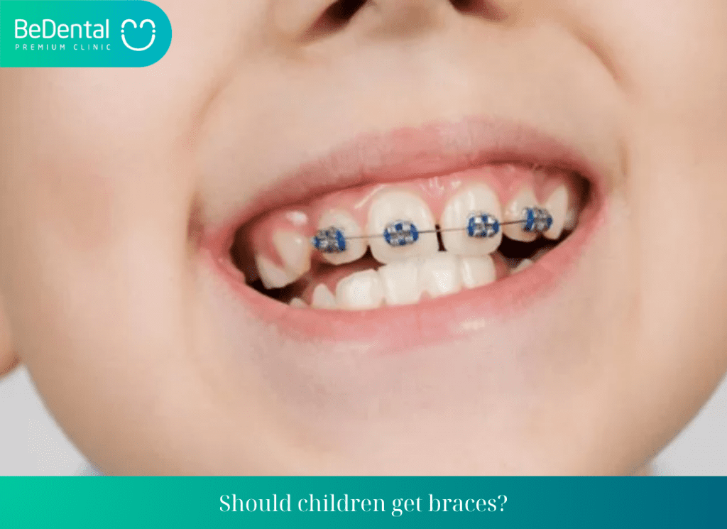 At What Age Can Children Get Braces?