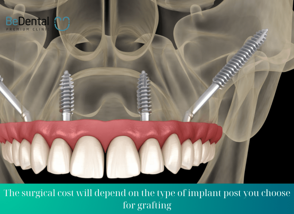 The surgical cost will depend on the type of implant post you choose for grafting