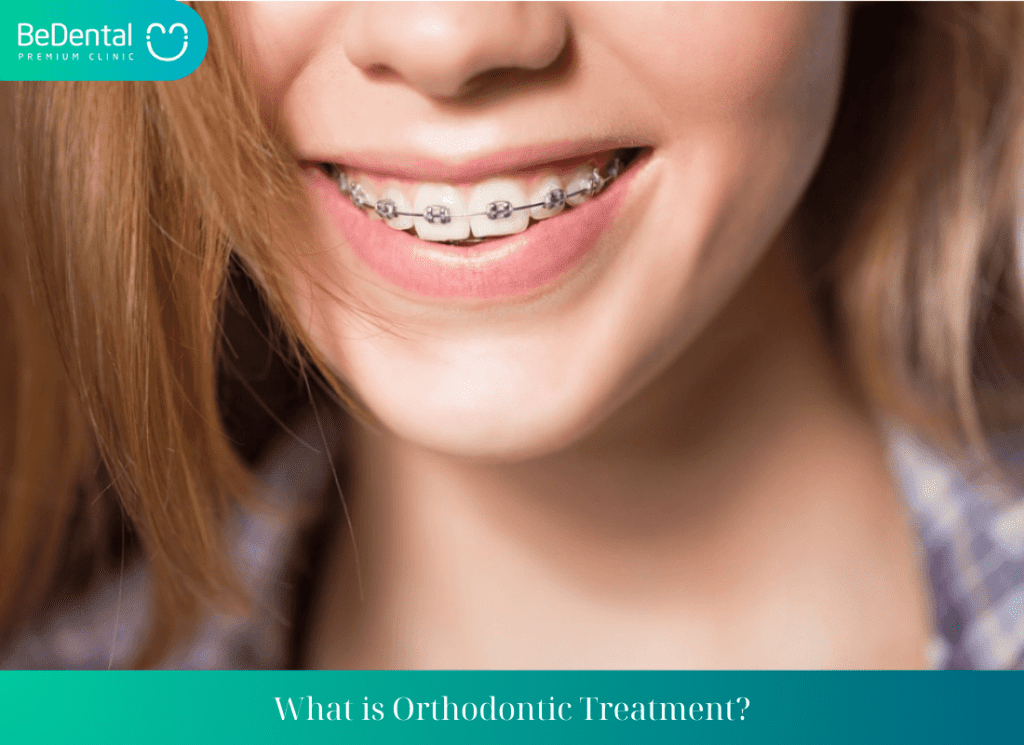 Compilation of Side Effects Caused by Orthodontic Treatment