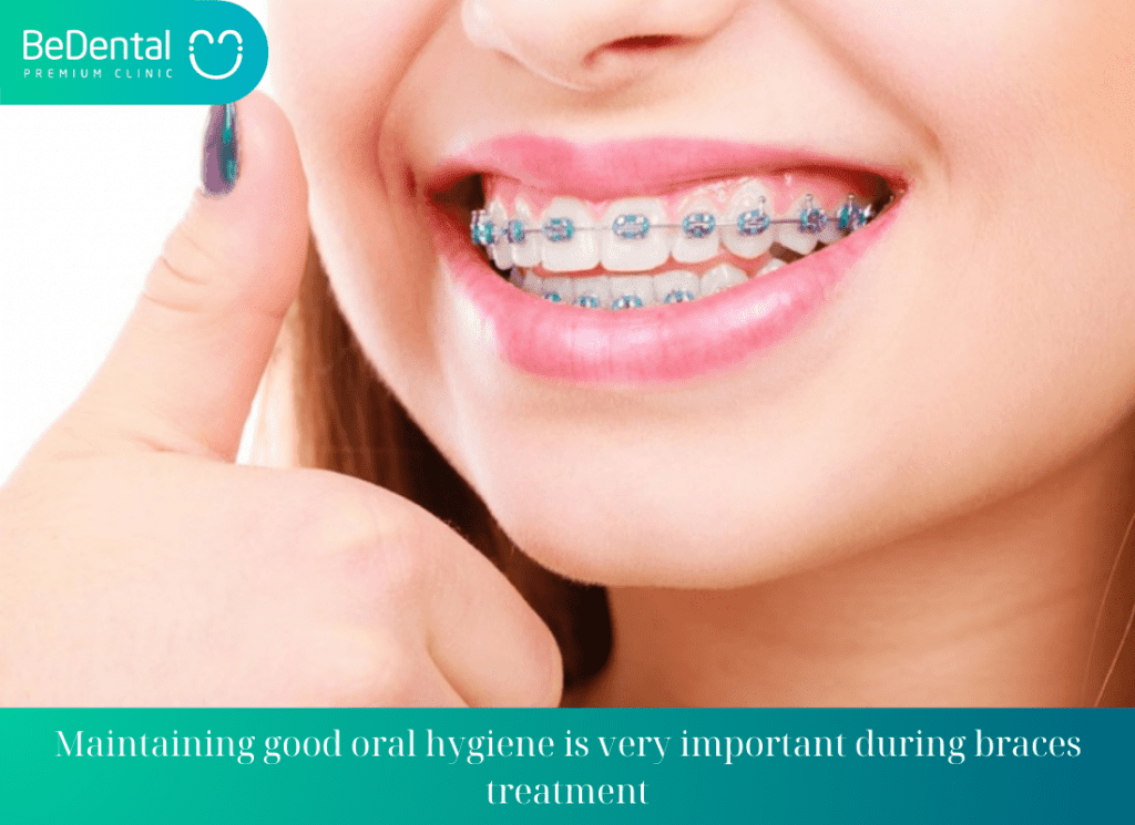 maintaining good oral hygiene is very important during braces treatment