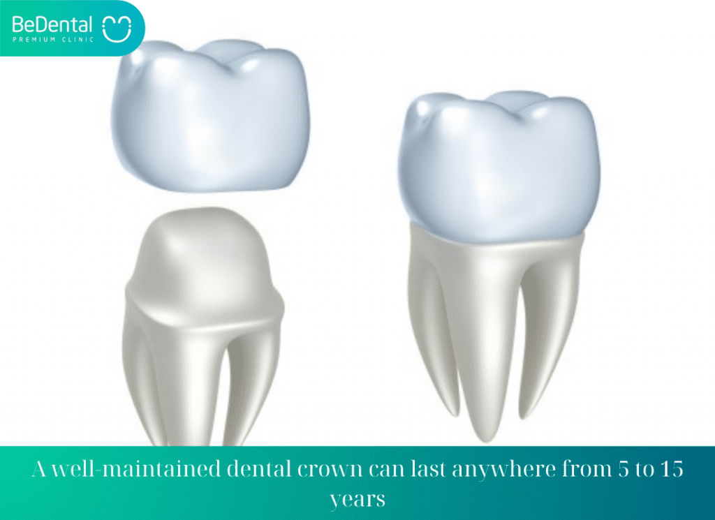 A well maintained dental crown can last anywhere from 5 to 15 years