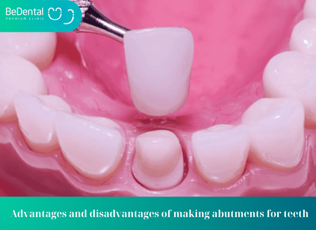 Advantages and disadvantages of making abutments for teeth