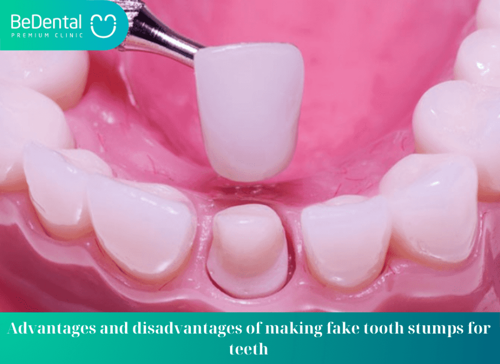 Advantages and disadvantages of making fake tooth stumps for teeth